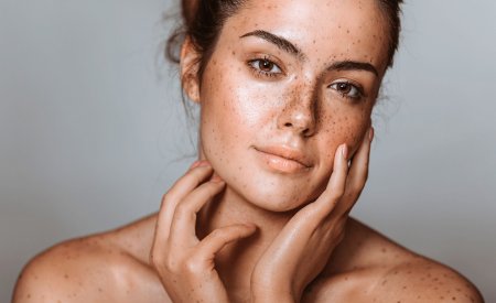Por qué tengo manchas en la piel? | Pigmentbio | BIODERMA