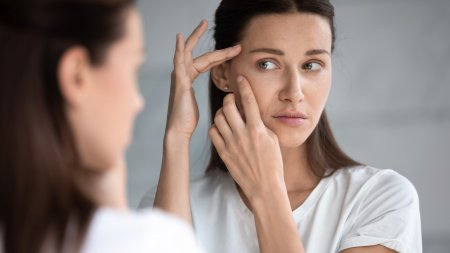 Women experiencing improved acne-prone skin with Sébium serum.